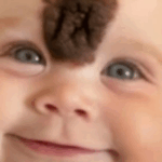 ¡Padres Remueven la Rara Marca de Nacimiento de su Bebé para Protegerla de la Crueldad! ¡Mira Cómo Luce Hoy!