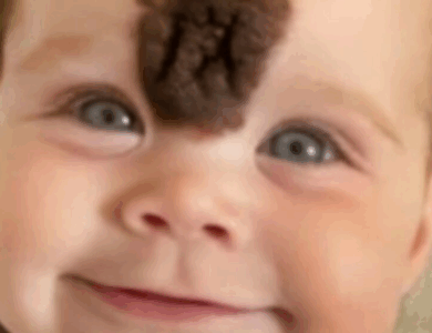 ¡Padres Remueven la Rara Marca de Nacimiento de su Bebé para Protegerla de la Crueldad! ¡Mira Cómo Luce Hoy!