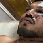 La policía confirmó que encontró un sobreviviente en el asiento 11A del avión de Air India La policía confirmó que encontró un sobreviviente en el asiento 11A del avión de Air India