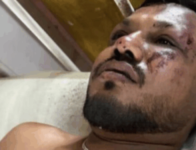 La policía confirmó que encontró un sobreviviente en el asiento 11A del avión de Air India La policía confirmó que encontró un sobreviviente en el asiento 11A del avión de Air India