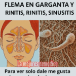 Remedios Naturales para Eliminar el Moco y la Flema en la Garganta Remedios Naturales para Eliminar el Moco y la Flema en la Garganta