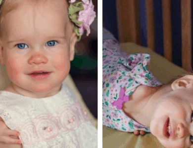 Una familia adoptiva regaló verdadero calor y amor a una niña que nació con particularidades físicas.