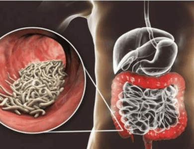 ¿Sabías que podrías tener parásitos sin saberlo?