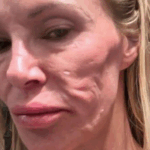 ¿Puedes Adivinar Quién Es Ella?: ¡Problemas de Salud Provocaron Cambios Significativos en su Apariencia! ¿Puedes Adivinar Quién Es Ella?: ¡Problemas de Salud Provocaron Cambios Significativos en su Apariencia!