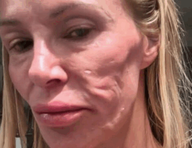 ¿Puedes Adivinar Quién Es Ella?: ¡Problemas de Salud Provocaron Cambios Significativos en su Apariencia!