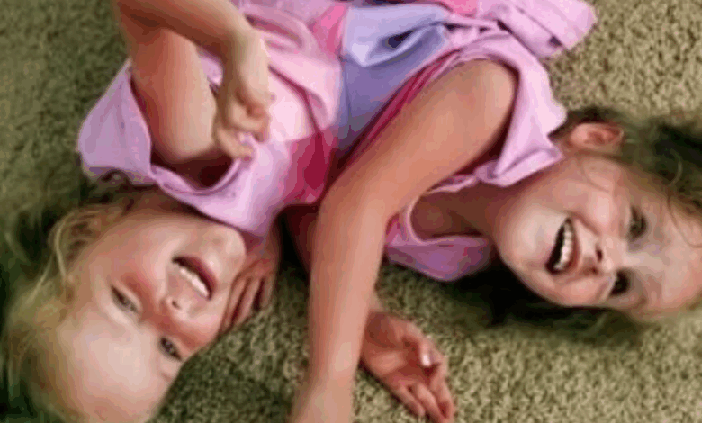 “¡Separados a los 4, Ahora 18 Años Después!”: ¿Cómo Lucen Estos Gemelos Ahora Tras una Cirugía de Separación de 26 Horas?