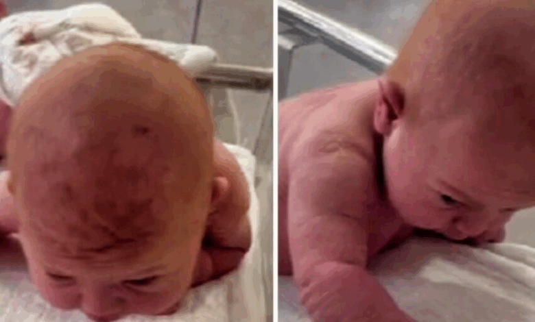 ¡Un Bebé Milagroso Que Gatea, Levanta La Cabeza Y Empieza A Hablar: ¡Mira El Increíble Momento!