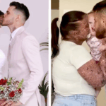 Una mujer es llamada ‘irresponsable’ por tener un bebé con su condición de piel, ella muestra a su ‘hermosa’ pequeña.