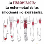 ¿Te duelen los músculos sin razón aparente? Podría ser fibromialgia ¿Te duelen los músculos sin razón aparente? Podría ser fibromialgia