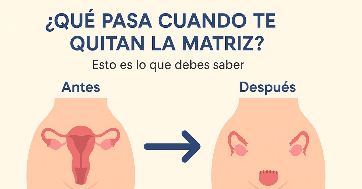 Esto es lo que debes saber ¿Qué pasa cuando te quitan la matriz? Esto es lo que debes saber ¿Qué pasa cuando te quitan la matriz?