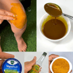 El Remedio Natural Que Alivia el Dolor de Rodilla al Instante