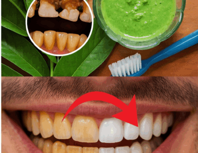 El Sorprendente Secreto de la Abuela para una Sonrisa de Hollywood: ¡Las Hojas de Guayaba Reveladas!