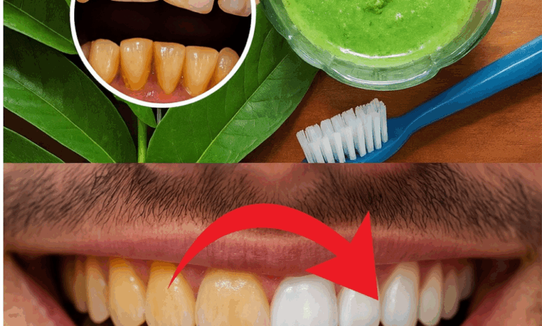 El Sorprendente Secreto de la Abuela para una Sonrisa de Hollywood: ¡Las Hojas de Guayaba Reveladas!