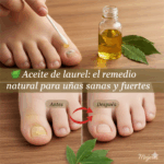 Laurel para Hongos en las Uñas: Remedio Natural y Efectivo Laurel para Hongos en las Uñas: Remedio Natural y Efectivo