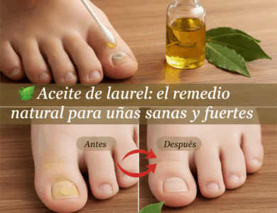 Laurel para Hongos en las Uñas: Remedio Natural y Efectivo Laurel para Hongos en las Uñas: Remedio Natural y Efectivo