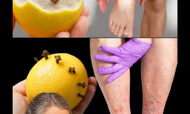 El remedio natural de mamá con limón que alivia dolores de piernas, reumatismo, varices, artritis y cefaleas