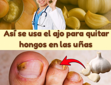 Cómo eliminar hongos de la piel, uñas, manos, pies y cuero cabelludo con ajo: el remedio natural más potente Cómo eliminar hongos de la piel, uñas, manos, pies y cuero cabelludo con ajo: el remedio natural más potente