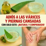 Aloe Vera para Piernas Cansadas y Várices: El Remedio Natural que Mejora la Circulación y Alivia la Inflamación