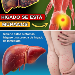 12 Signos Tempranos de Cirrosis Hepática que Nunca Debes Ignorar