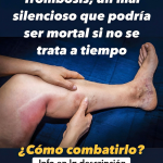 Las 6 Mejores Infusiones para Mantener Saludables tus Arterias